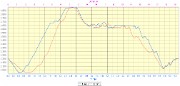 20161218-000-Essaure-profile